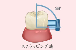・スクラッビング法の図解（歯ブラシ90度）